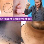 Apparition de veinules disgracieuses sur les jambes : solutions d’urgence avant la consultation