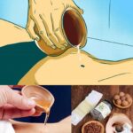 ⚪ Ces mystérieuses petites boules blanches au fond de la gorge : explications et remèdes