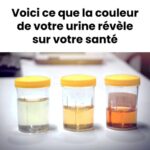 Ronflements nocturnes : Décryptage des causes et solutions pour un sommeil apaisé