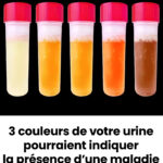 🧄 Comment utiliser l’ail pour se débarrasser des nuisibles : souris, mouches, poux, cafards, lézards, moustiques et cafards de cuisine