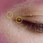 Une recette naturelle pour nettoyer les artères et faire baisser le cholestérol