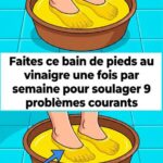 Peu de gens connaissent la véritable raison de ce petit nœud sur les culottes féminines